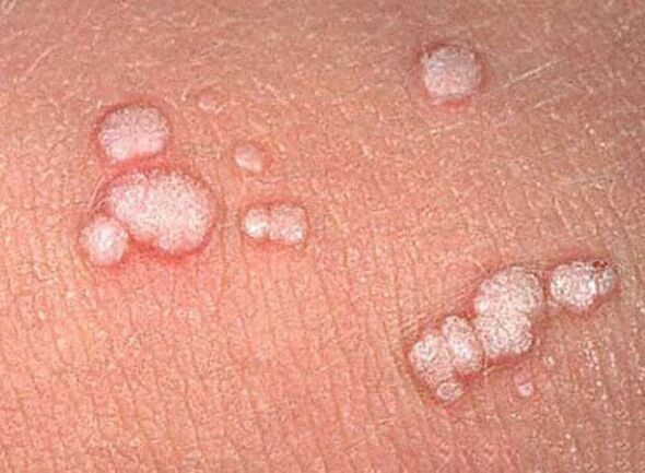 Papiles in the human body