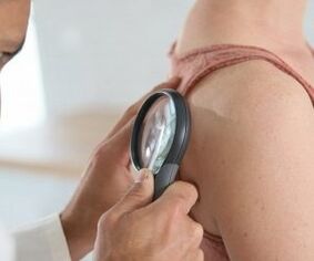 How to determine the Papilloma virus