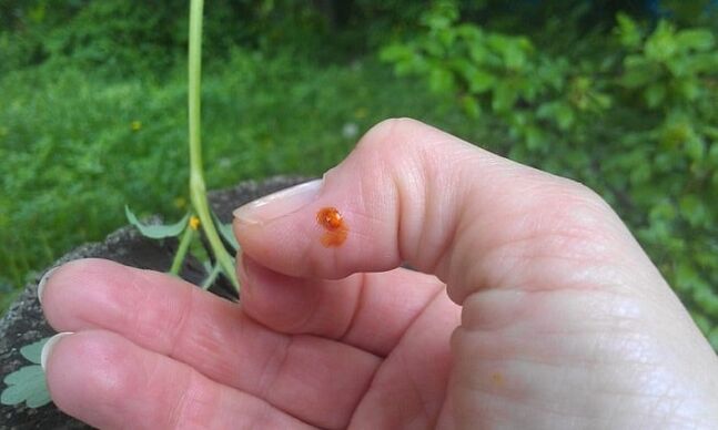Celandine turned to her finger